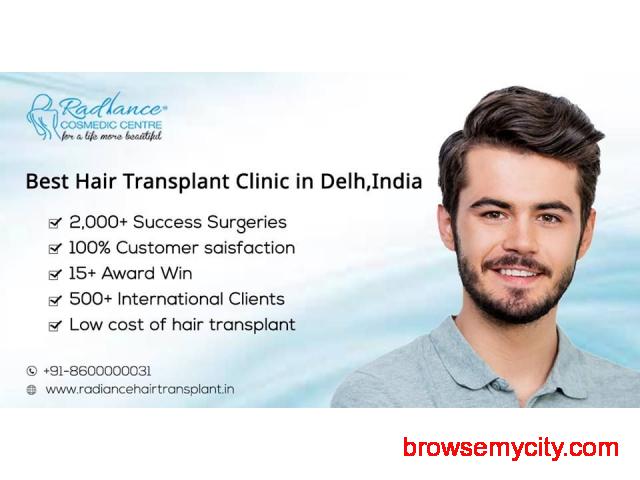 Know the best Hair Transplant In Delhi-India - 19578
