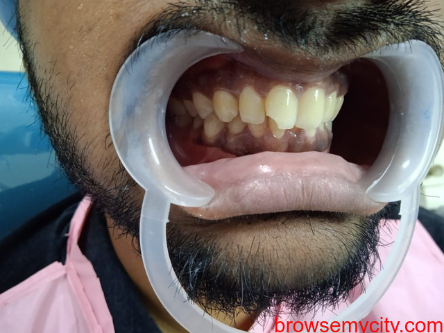 dentist in kharghar - 5/5