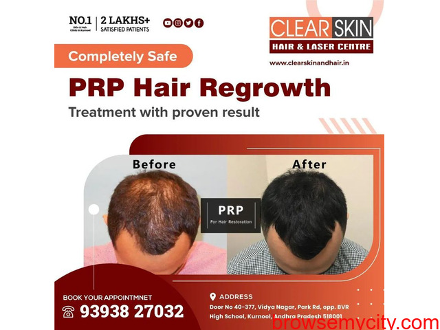 PRP hair Treatment in hyderabad - 1/1