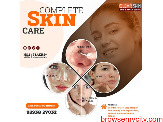 Best Advance Skin Tag Removal In India || Laser Treatment || Skin Care - 1/1