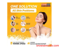 Best Advance Acne Scar Removal Treatment in Kurnool || Laser Treatment || Skin Care  || Painfree ||