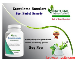Granuloma Annulare Natural Treatment by Natural Herbs Clinic