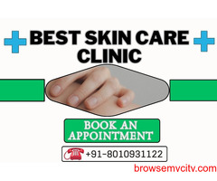 Best skin care clinic in Dwarka Delhi  Call 8010931122