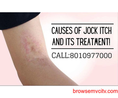 Jock itch infection treatment  in Delhi Call 8010977000