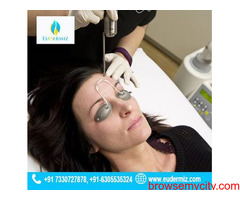 Affordable Q Switched Nd:YAG Laser Treatment in Hyderabad