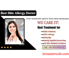 Best Skin Allergy Doctor in Delhi Call 8010977000