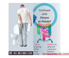 Treatment of fissure and fistula without surgery in Delhi