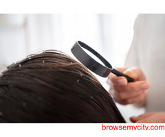 Dandruff Treatment in Madurai | Renew Plus for healthy hair