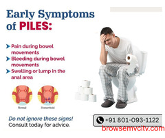 Effective Piles Treatment Without Surgery in Defence Colony Delhi