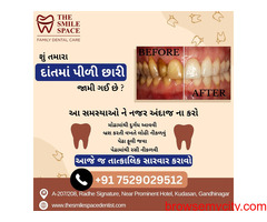 Teeth cleaning in Gandhinagar