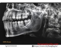 OPG X-Ray Cost Near You Affordable & Quick Scan
