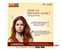 best vascular laser treatment in india