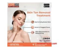 Best Advance Syringoma Treatment in indiaGet smooth, blemish-free skin with the best advanced syring