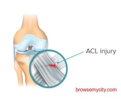 Expert Orthopaedic Care by Dr. Abhimanyu Singh at StepRight