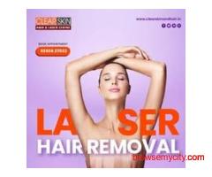 Best Acne Scar Laser Treatment in India
