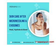 Skin Care After Microneedling & Exosomes– Heal, Hydrate & Glow!