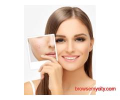 Top Dermatologist in Chandigarh