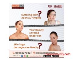 Mesotherapy hair Treatment  in india