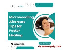 Microneedling Aftercare Tips for Faster Healing | Advancexo