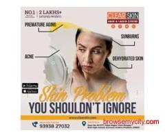 Best Advanced Laser Treatment for Birthmark Removal in India