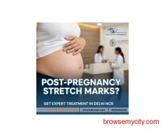 Post-Pregnancy Stretch Marks? Get Expert Treatment in Delhi NCR