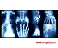 X-ray & OPG Near Me – Trusted Digital X‑Ray Centre in South Delhi