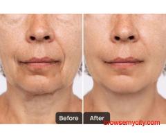 Dermatology Treatments in Chandigarh | Skinology+ by Dr. Sheenam