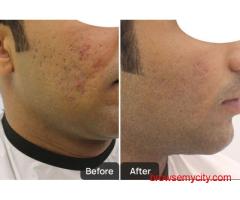 Dermatology Treatments in Chandigarh | Skinology+ by Dr. Sheenam