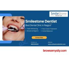 Smilestone Dental Clinic - Best Dentist in Nagpur