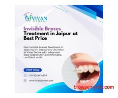 Invisible Braces Treatment in Jaipur at Best Price