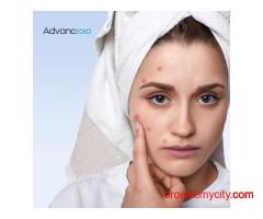 Best Treatment for Pigmentation | Advancexo