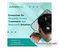 Exosomes for Alopecia Areata Treatment | Hair Regrowth Solution