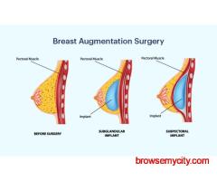 Safe & Advanced Breast Surgery in Delhi & NCR