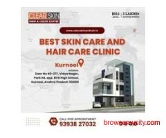 Best Birthmark removal laser treatment in india