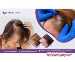 Best Hair Restoration in Surat – CallistoClinic