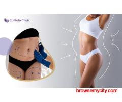 Trusted Liposuction Experts in Surat – Callisto Clinic