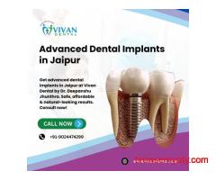 Advanced Dental Implants in Jaipur