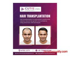 Why Advanced Hair Transplantation Techniques Give Better Results?