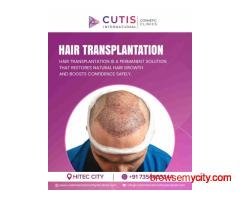 Best Hair Transplantation Treatments for Natural Hair Growth
