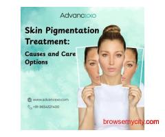 Skin Pigmentation Treatment: Causes and Care Options