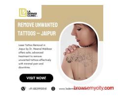 Remove Unwanted Tattoos – Jaipur