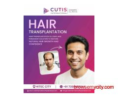 Which Is the Best Hair Transplantation Clinic in Hyderabad?