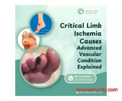 Critical Limb Ischemia Causes | Risk Factors & Vascular Damage