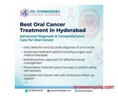 Best oral Cancer treatment in Hyderabad
