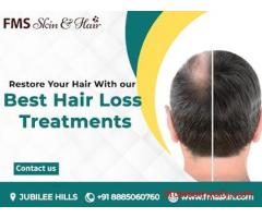 Best Hair Loss Treatment in Hyderabad – PRP & Hair Regrowth