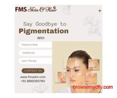 Best Pigmentation Treatment in Hyderabad