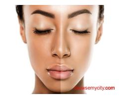 Skin whitening Treatment in Jubilee hills
