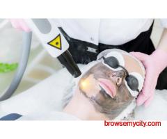 Best Carbon Peel Laser Treatment - Smooth, Radiant Skin