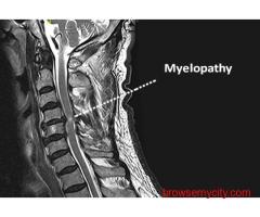 Best scoliosis doctor in Vizag