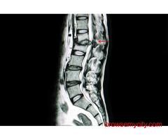 Best scoliosis doctor in Vizag